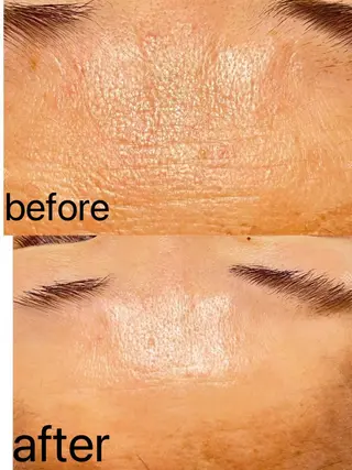 Nature Souce毛穴専門店のその他イメージ