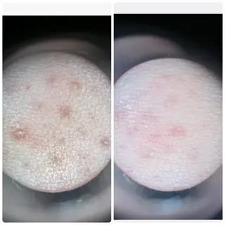 FLEUR大阪・整体 ・ハイフ・痩身・小顔のエステ・リラクイメージ