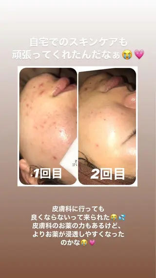 【足圧】鬼👹リンパ 身体整うサロンのエステ・リラクイメージ