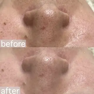 アイブロウ&フェイシャルサロンa‘lm所属・WAX脱毛/肌質改善 眉毛とお肌のサロンのエステ・リラクイメージ