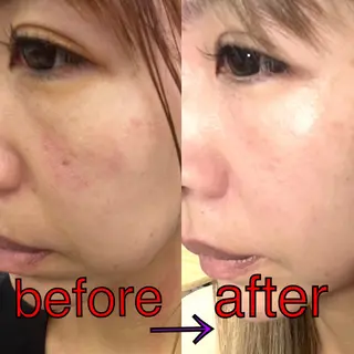 SHINY エステサロンのその他イメージ