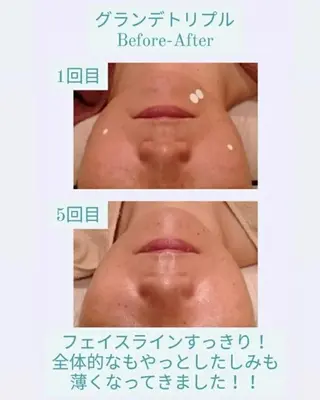 ラブニール 恵比寿店のエステ・リラクイメージ