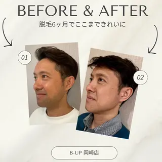 メンズ B-UP所属・r inのエステ・リラクイメージ