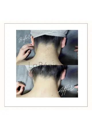 脱毛/美肌【皮膚科看 護師経営】ラベニールのエステ・リラクイメージ