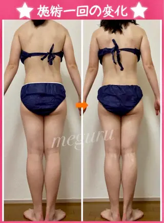 ショート カラー パーマ ヘアアレンジ メンズ キッズ ネイル マツエク・マツパ 痩身&ボディ 結果出し🌟丹野のエステ・リラクイメージ