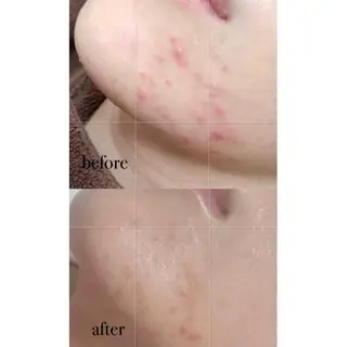 Amv. mananoのエステ・リラクイメージ