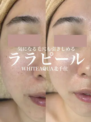WHITE AQUA 北千住店のエステ・リラクイメージ