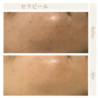 privatesalon icca所属・mana iccaのエステ・リラクイメージ