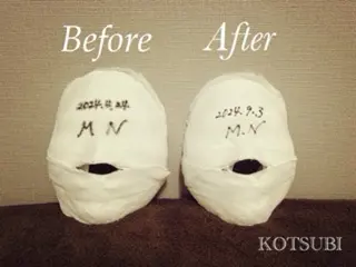 小顔矯正コルギ KOTSUBIのその他イメージ