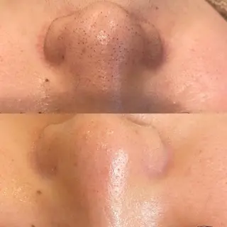 VERY VERY九条店所属・ベリーベリー🌹 九条店のエステ・リラクイメージ