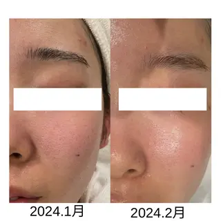 DeI'm   名古屋栄所属・小林 玲菜のエステ・リラクイメージ