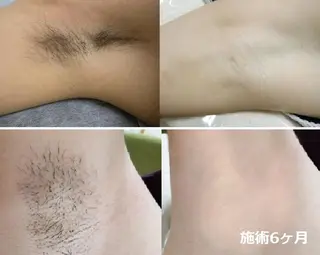 全身脱毛&VIO脱毛 紹介率№1♪リナ♪のエステ・リラクイメージ