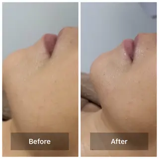 bonuru salonのエステ・リラクイメージ