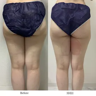 冷却専門店 SLARIのエステ・リラクイメージ