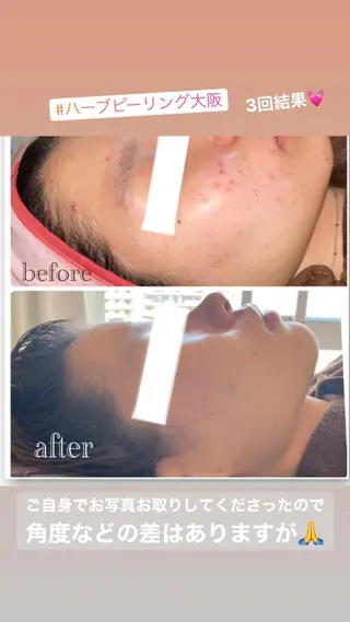 FLEUR大阪・美容 整体・痩身・小顔のエステ・リラクイメージ