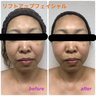 高速脱毛エステ リアンのエステ・リラクイメージ