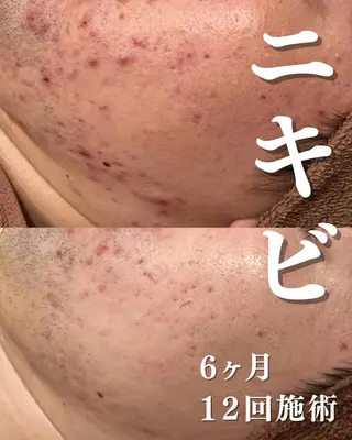 触れたくなる モテ肌へ...❤︎のエステ・リラクイメージ