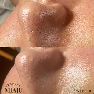 美肌専門サロン MIAJUのエステ・リラクイメージ