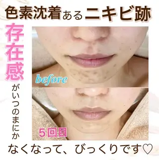 オーダーメイドエステ　ソワンドビジュー所属・美肌×小顔専門/ 亀澤いずみのエステ・リラクイメージ