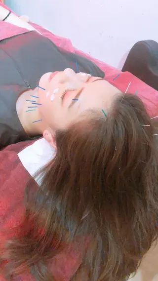 美容鍼灸女性専用 りんご鍼灸治療院のその他イメージ