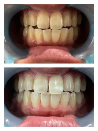 SESUNNY セサ二ー　SAYAのマツエク・マツパデザイン