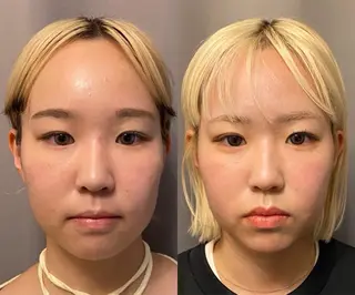 医療提携×美容整体 小顔ハイフピーリングのエステ・リラクイメージ