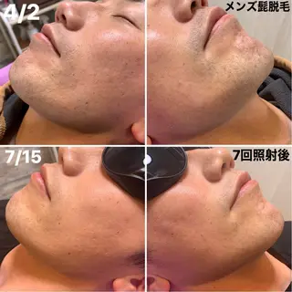 メンズ 脱毛＆エステサロン【アンリミット】所属・森谷 莉美のエステ・リラクイメージ