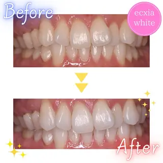 セルフホワイトニング エクシアたまプラーザ店所属・セルフホワイトニング エクシアたまプラーザのその他イメージ