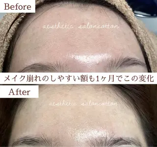 都度払い 肌質改善専門サロンのエステ・リラクイメージ