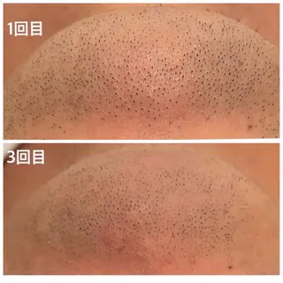 メンズ メンズ脱毛サロン　SHINKA所属・メンズ脱毛サロン SHINKAのエステ・リラクイメージ