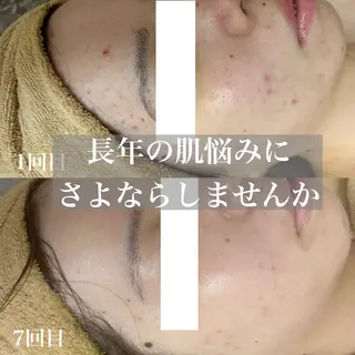 WHITE AQUA 北千住店のエステ・リラクイメージ