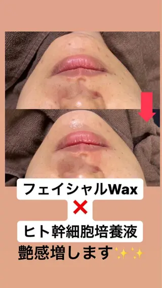 産毛専門店 Bittoのエステ・リラクイメージ