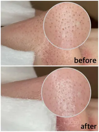 マツエク・マツパ 韓国肌管理 【毛穴専科】のエステ・リラクイメージ