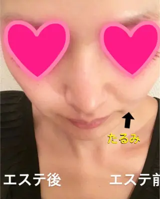 skinLabo所属・saya Mのエステ・リラクイメージ