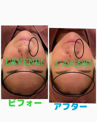 ラブニール 恵比寿店のエステ・リラクイメージ