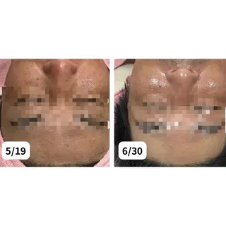 フェイシャル/脱毛 ジョアアンジェ竹田のエステ・リラクイメージ