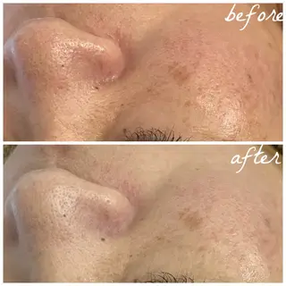 メンズ メナード岐阜茜部 杉浦のエステ・リラクイメージ