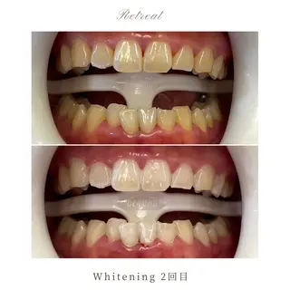 メンズ キッズ Retreatリトリート所属・歯科医院提携 Retreatのその他イメージ