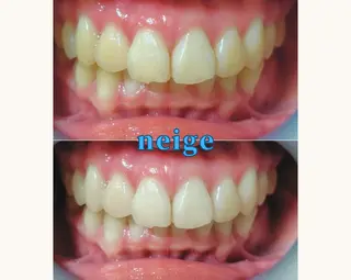 ホワイトニングサロン ネージュ(女性専用)のその他イメージ