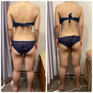 FLEUR大阪・整体 ・ハイフ・痩身・小顔のエステ・リラクイメージ