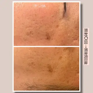 ☆痩身/小顔☆ 結果出します☆のエステ・リラクイメージ