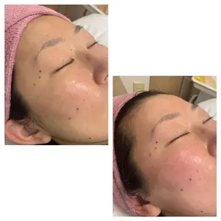 lafleur Yurinaのエステ・リラクイメージ