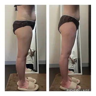 ハイパーナイフ専門店 Salon de COCO所属・Salon de COCOのエステ・リラクイメージ