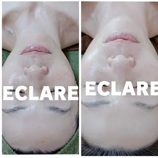グリーンピール専門店 ECLAREのエステ・リラクイメージ