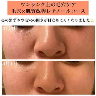 Bellesthe （ベルエステ）のエステ・リラクイメージ