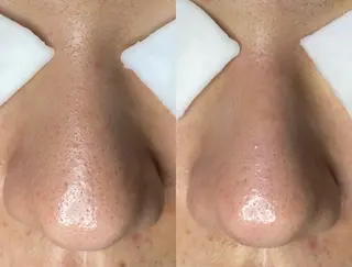 Re:Belle所属・Re:Belle 久留米 : 中島のエステ・リラクイメージ