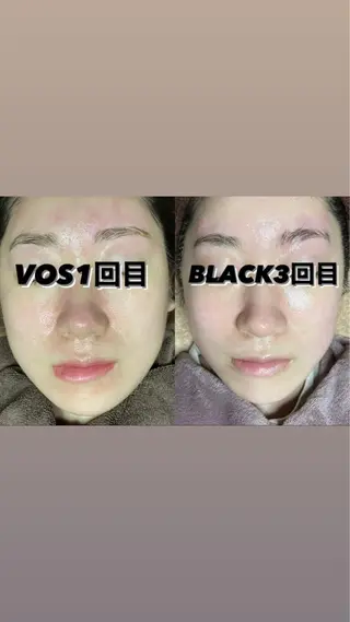 代表 MOMOの眉毛・アイブロウイメージ