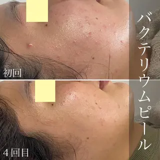 メンズ歓迎🙆‍♀️ エステ/ネイルISTのエステ・リラクイメージ