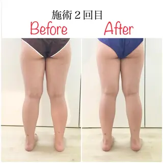 小顔トータルサロンUnica（ウニカ）所属・小顔トータルサロン Unicaのエステ・リラクイメージ