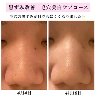 Bellesthe (ベルエステ)のエステ・リラクイメージ